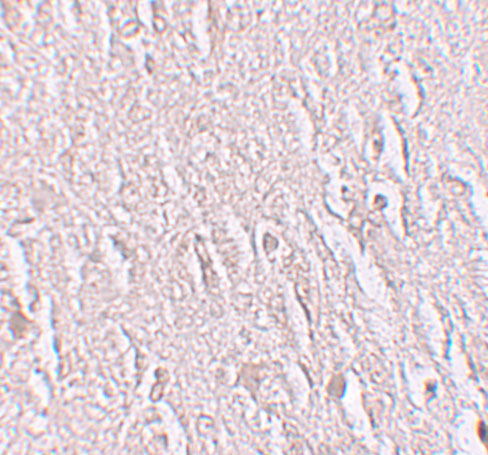 a14543 zbtb5 primary antibodies ihc testing 2