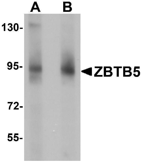 a14543 zbtb5 primary antibodies wb testing 1