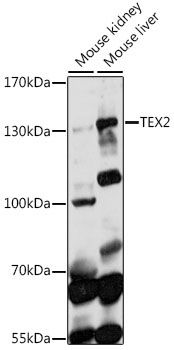 a14552 tex2 primary antiboties wb testing 1