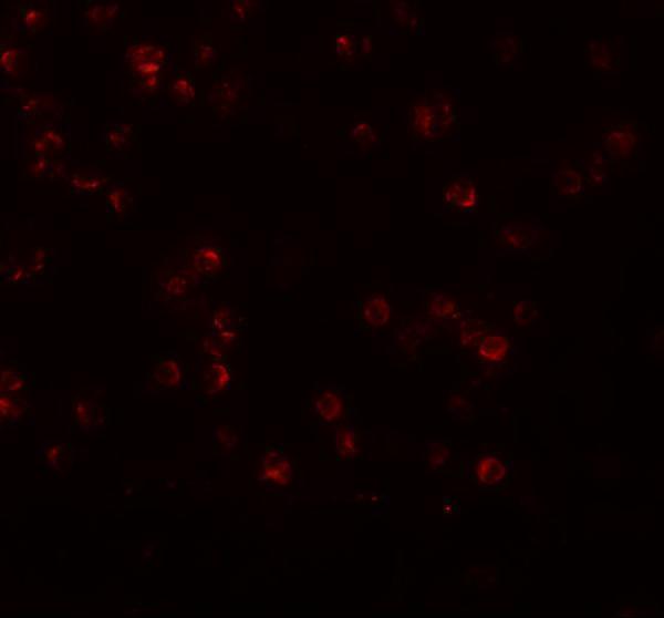 Immunofluorescence of APC13 in Jurkat cells with APC13 antibody at 20 μg/mL