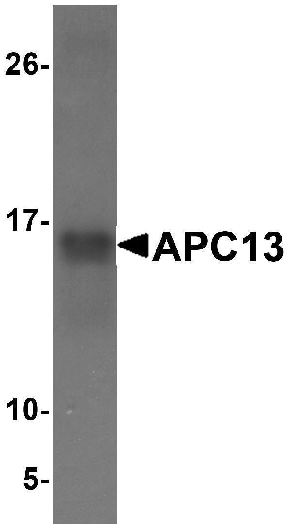 Western blot analysis with 25ng of recombinant APC13 protein with APC13 antibody at ?1 μg/ml