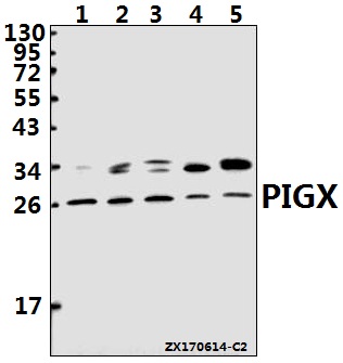 Western blot (WB) analysis of PIGX polyclonal antibody at 1:1000 dilution
Lane1:L02 whole cell lysate(40ug)
Lane2:HEK293T whole cell lysate(40ug)
Lane3:A549 whole cell lysate(40ug)
Lane4:C6 whole cell lysate(40ug)
Lane5:CT26 whole cell lysate(40ug)