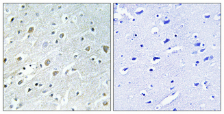 Immunohistochemical analysis of paraffin-embedded Human brain