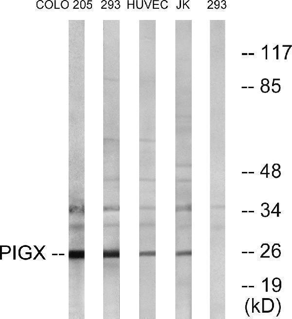 Western blot analysis of lysates from 293, COLO, HUVEC, and Jurkat cells, using PIGX Antibody