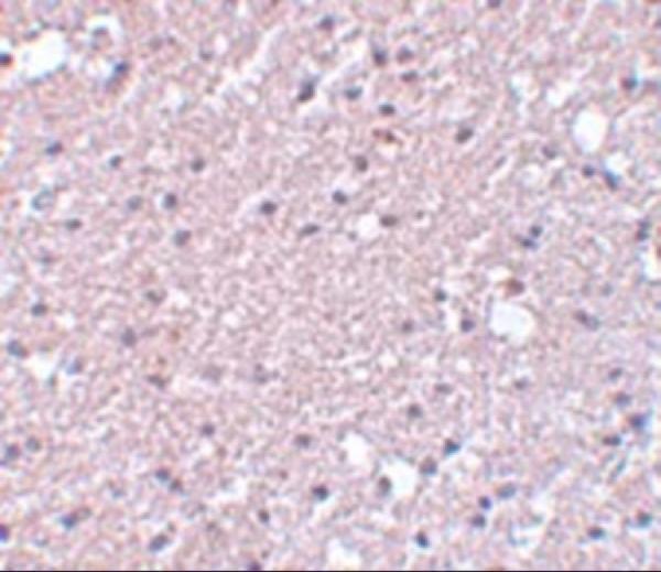a14566 tmem184a primary antibodies ihc testing 2