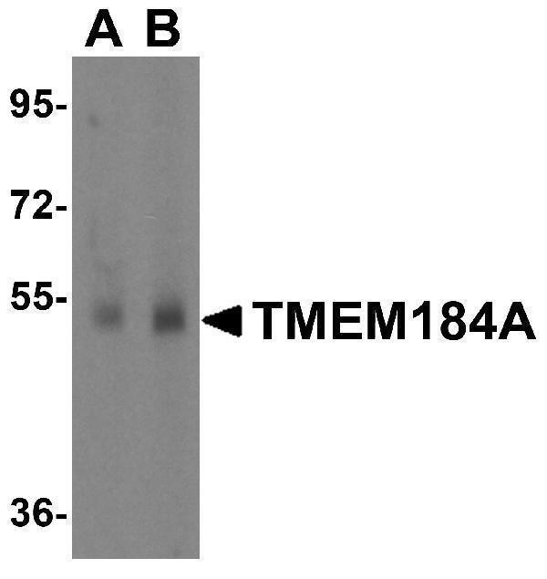 a14566 tmem184a primary antibodies wb testing 1