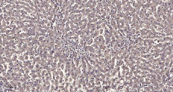 a14567 rabl2a primary antibodies ihc testing 1