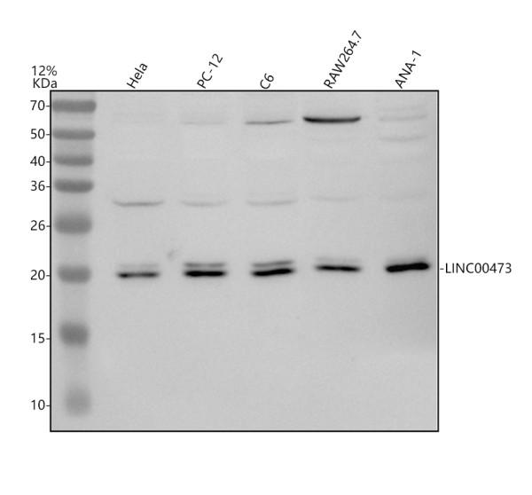 Western blot analysis of LINC00473 using anti-LINC00473 antibody (A14568)