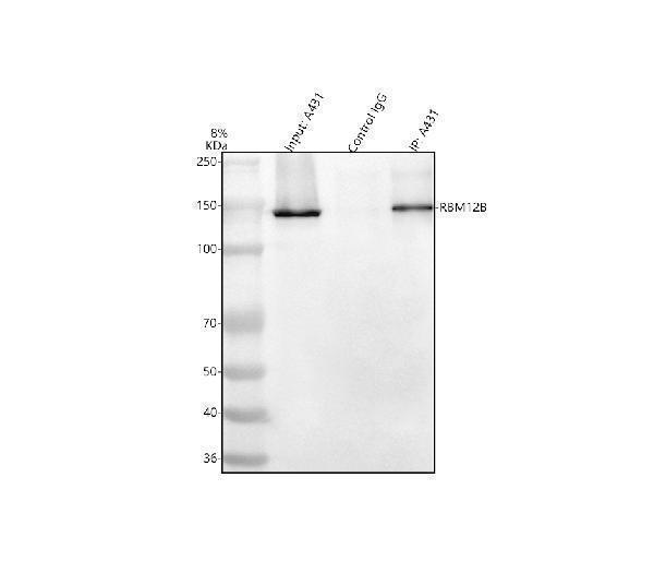 Immunoprecipitating (IP) RBM12B in A431 whole cell lysate