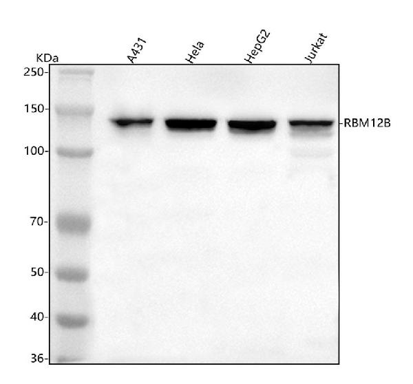 Figure 1. Western blot analysis of RBM12B using anti-RBM12B antibody (A14571-1). Electrophoresis was performed on a 5-20% SDS-PAGE gel at 70V (Stacking gel) / 90V (Resolving gel) for 2-3 hours. The sample well of each lane was loaded with 30 ug of sample under reducing conditions. Lane 1: human A431 whole cell lysates, Lane 2: human Hela whole cell lysates, Lane 3: human HepG2 whole cell lysates, Lane 4: human Jurkat whole cell lysates. After electrophoresis, proteins were transferred to a nitrocellulose membrane at 150 mA for 50-90 minutes. Blocked the membrane with 5% non-fat milk/TBS for 1.5 hour at RT. The membrane was incubated with rabbit anti-RBM12B antigen affinity purified polyclonal antibody (Catalog # A14571-1) at 0.5 microg/mL overnight at 4°C, then washed with TBS-0.1%Tween 3 times with 5 minutes each and probed with a goat anti-rabbit IgG-HRP secondary antibody at a dilution of 1:5000 for 1.5 hour at RT. The signal is developed using an Enhanced Chemiluminescent detection (ECL) kit (Catalog # EK1002) with Tanon 5200 system. A specific band was detected for RBM12B at approximately 130 kDa. The expected band size for RBM12B is at 118 kDa.