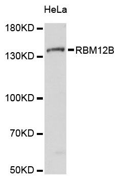 a14571 rbm12b primary antiboties wb testing 1