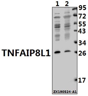 Western blot (WB) analysis of TNFAIP8L1 pAb at 1:500 dilution
Lane1:A549 whole cell lysate(40ug)
Lane2:HepG2 whole cell lysate(40ug)