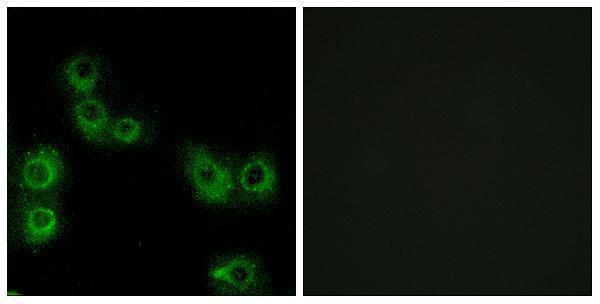 a14574 mrgprx3 primary antibodies if testing 1