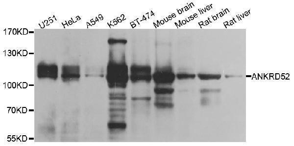 Immunohistochemistry of paraffin-embedded rat lung using ANKRD52 antibody  at dilution of 1:100 