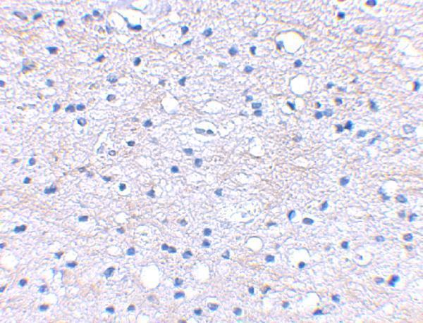 a14584 hapln2 primary antibodies ihc testing 2