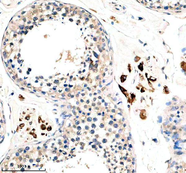 a14588 1 hspb9 primary antibodies ihc testing 1
