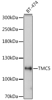 a14593 tmc5 primary antiboties wb testing 1