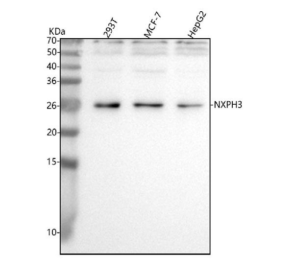 Figure 1. Western blot analysis of NXPD3 using anti-NXPD3 antibody (A14597-3). Electrophoresis was performed on a 5-20% SDS-PAGE gel at 70V (Stacking gel) / 90V (Resolving gel) for 2-3 hours. The sample well of each lane was loaded with 30 ug of sample under reducing conditions. Lane 1: human 293T whole cell lysates, Lane 2: human MCF-7 whole cell lysates, Lane 3: human HepG2 whole cell lysates. After electrophoresis, proteins were transferred to a nitrocellulose membrane at 150 mA for 50-90 minutes. Blocked the membrane with 5% non-fat milk/TBS for 1.5 hour at RT. The membrane was incubated with rabbit anti-NXPD3 antigen affinity purified polyclonal antibody (Catalog # A14597-3) at 0.5 microg/mL overnight at 4°C, then washed with TBS-0.1%Tween 3 times with 5 minutes each and probed with a goat anti-rabbit IgG-HRP secondary antibody at a dilution of 1:5000 for 1.5 hour at RT. The signal is developed using an Enhanced Chemiluminescent detection (ECL) kit (Catalog # EK1002) with Tanon 5200 system. A specific band was detected for NXPD3 at approximately 28 kDa. The expected band size for NXPD3 is at 28 kDa.