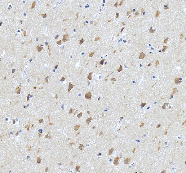 IHC analysis of Neurexophilin 3/NXPH3 using anti-Neurexophilin 3/NXPH3 antibody (A14597-3)