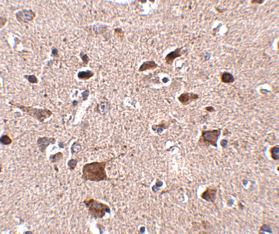 Immunohistochemistry of CCDC134 in human brain tissue with CCDC134 antibody at 2