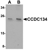 Western blot analysis of CCDC134 in rat brain tissue lysate with CCDC134 antibody at (A) 1 and (B) 2 μg/mL