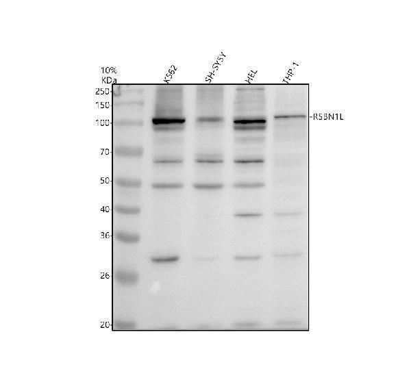 Western blot analysis of RSBN1L using anti-RSBN1L antibody (A14622-1)
