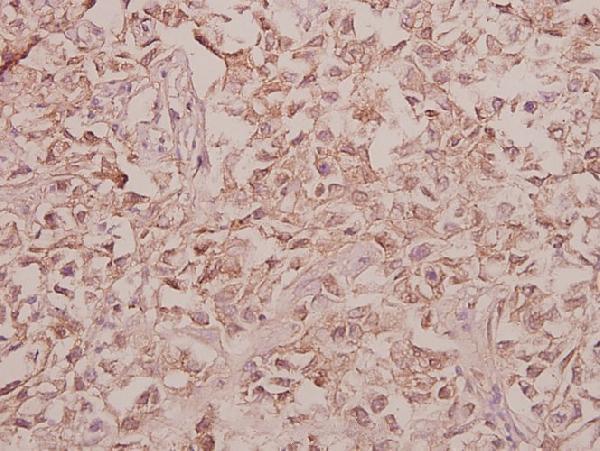 a14632y341 arsf primary antiboties ihc testing 2