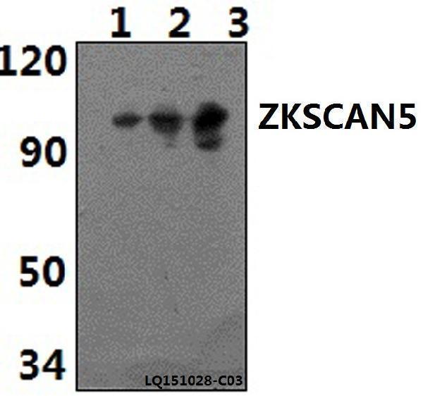 Western blot (WB) analysis of ZKSCAN5 polyclonal antibody at 1:500 dilution
Lane1:RAW264