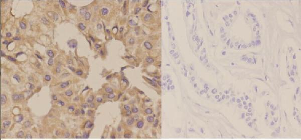 Immunohistochemistry (IHC) analyzes of KVβ