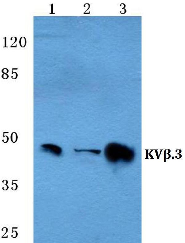 Western blot (WB) analysis of KVβ