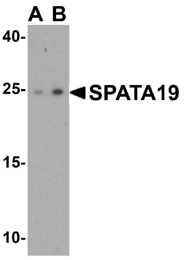 a14636 spata19 primary antibodies wb testing 1