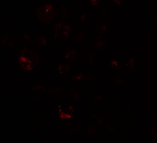 a14637 prickle4 primary antibodies if testing 3