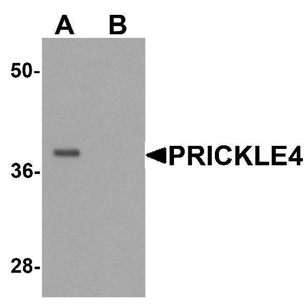 a14637 prickle4 primary antibodies wb testing 1