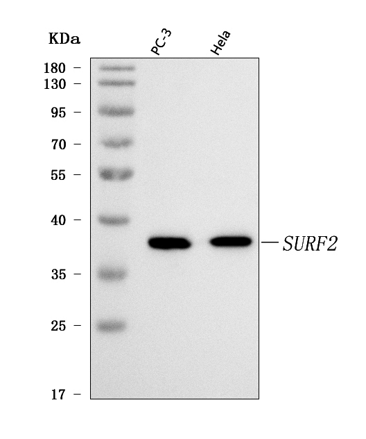 Figure 1. Western blot analysis of SURF2 using anti-SURF2 antibody (A14641). Electrophoresis was performed on a 5-20% SDS-PAGE gel at 70V (Stacking gel) / 90V (Resolving gel) for 2-3 hours. The sample well of each lane was loaded with 30 ug of sample under reducing conditions. Lane 1: human PC-3 whole cell lysates, Lane 2: human Hela whole cell lysates. After electrophoresis, proteins were transferred to a nitrocellulose membrane at 150 mA for 50-90 minutes. Blocked the membrane with 5% non-fat milk/TBS for 1.5 hour at RT. The membrane was incubated with rabbit anti-SURF2 antigen affinity purified polyclonal antibody (Catalog # A14641) at 0.5 microg/mL overnight at 4°C, then washed with TBS-0.1%Tween 3 times with 5 minutes each and probed with a goat anti-rabbit IgG-HRP secondary antibody at a dilution of 1:5000 for 1.5 hour at RT. The signal is developed using an Enhanced Chemiluminescent detection (ECL) kit (Catalog # EK1002) with Tanon 5200 system. A specific band was detected for SURF2 at approximately 38 kDa. The expected band size for SURF2 is at 30 kDa.