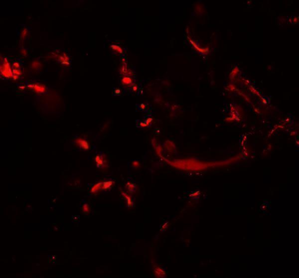 Immunofluorescence of HHATL in human skin tissue with HHATL antibody at 20 μg/mL