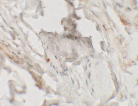 Immunohistochemistry of HHATL in human skin tissue with HHATL antibody at 2