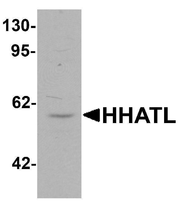 Western blot analysis of HHATL in 3T3 cell lysate with HHATL antibody at 1 μg/mL