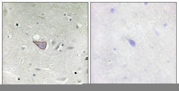 a14662 1 armcx3 primary antibodies ihc testing 2