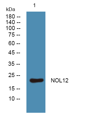 Western blot analysis of lysates from PC12 cells, primary antibody was diluted at 1:1000, 4°over night