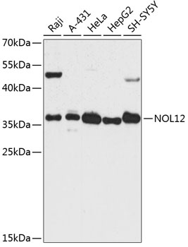 Western blot analysis of extracts of various cell lines, using NOL12 antibody  at 1:3000 dilution