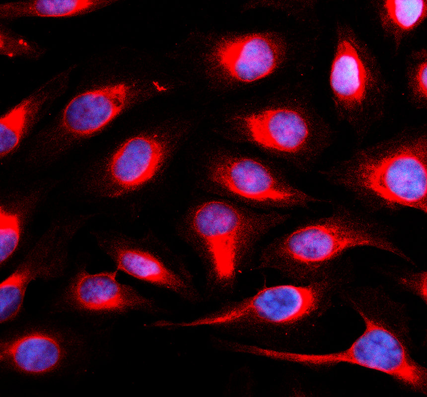 IF analysis of METTL4 using anti-METTL4 antibody (A14674-1)