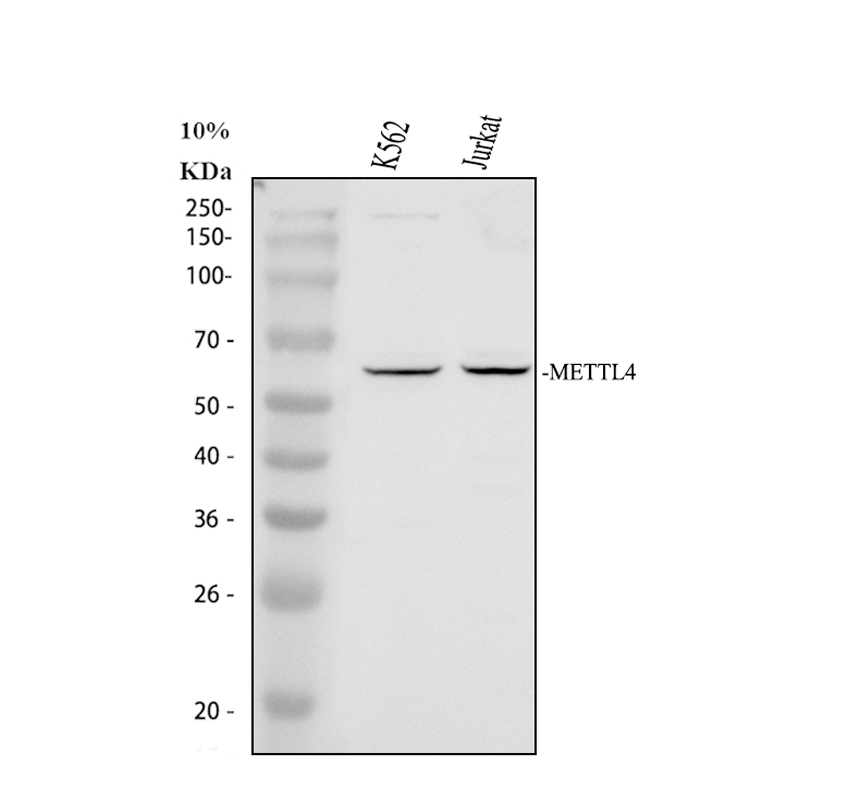 Western blot analysis of METTL4 using anti-METTL4 antibody (A14674-1)