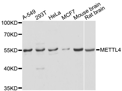 a14674 mettl4 primary antiboties wb testing 1