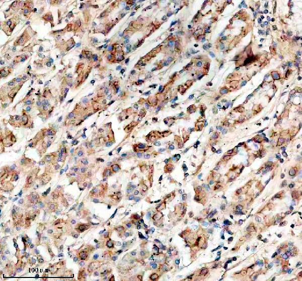 a14683 1 slc26a10 primary antibodies ihc testing 1