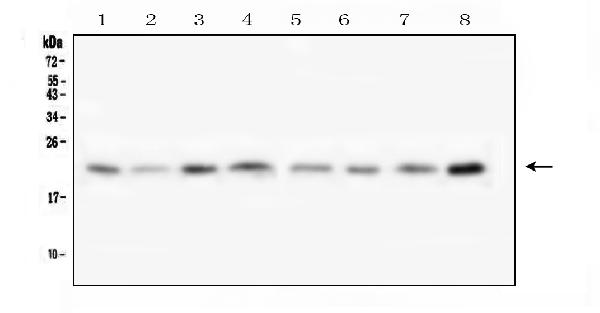 Western blot analysis of TMEM199 using anti-TMEM199 antibody (A14686-1). Electrophoresis was performed on a 5-20% SDS-PAGE gel at 70V (Stacking gel) / 90V (Resolving gel) for 2-3 hours. The sample well of each lane was loaded with 50ug of sample under reducing conditions. Lane 1: human Hela whole cell lysates, Lane 2: human placenta tissue lysates, Lane 3: human Caco-2 whole cell lysates, Lane 4: human T-47D whole cell lysates, Lane 5: human U-87MG whole cell lysates, Lane 6: human K562 whole cell lysates, Lane 7: human U2OS whole cell lysates, Lane 8: human PC-3 whole cell lysates. After Electrophoresis, proteins were transferred to a Nitrocellulose membrane at 150mA for 50-90 minutes. Blocked the membrane with 5% Non-fat Milk/ TBS for 1.5 hour at RT. The membrane was incubated with rabbit anti-TMEM199 antigen affinity purified polyclonal antibody (Catalog # A14686-1) at 0.5 μg/mL overnight at 4°C, then washed with TBS-0.1%Tween 3 times with 5 minutes each and probed with a goat anti-rabbit IgG-HRP secondary antibody at a dilution of 1:10000 for 1.5 hour at RT. The signal is developed using an Enhanced Chemiluminescent detection (ECL) kit (Catalog # EK1002) with Tanon 5200 system. A specific band was detected for TMEM199 at approximately 23KD. The expected band size for TMEM199 is at 23KD.