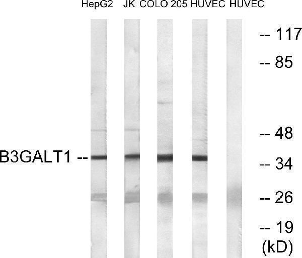 a14688t1 b3galt1 primary antibodies wb testing 2