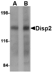 Western blot analysis of Disp2 in rat brain tissue lysate with Disp2 antibody at (A) 1 and (B) 2 μg/mL