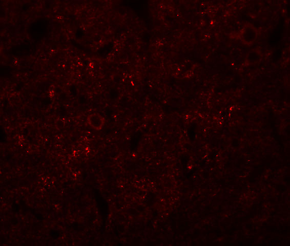 a14692 syngr3 primary antibodies if testing 3