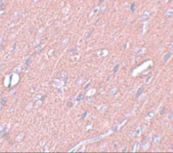 a14692 syngr3 primary antibodies ihc testing 2