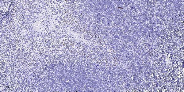 Immunohistochemical analysis of paraffin-embedded human tonsil